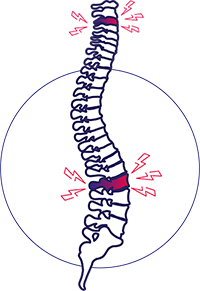 Illustratie wervelkolom